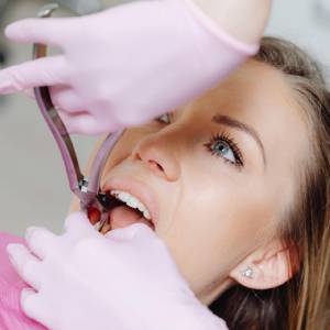 Signs You May Need a Tooth Extraction in Pittsburg